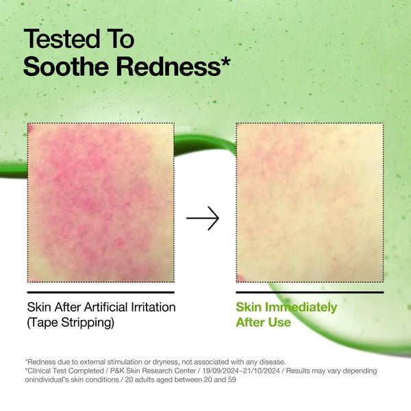 Azelaic Acid Hyaluron Serum - Heavenskin