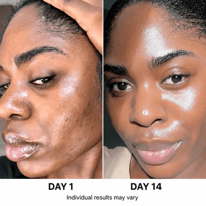 Ultimate korean skincare set