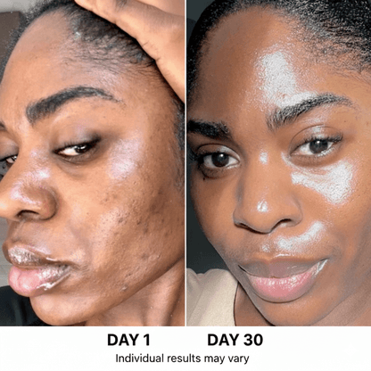 ANUA ultimate Korean skincare set - Heavenskin