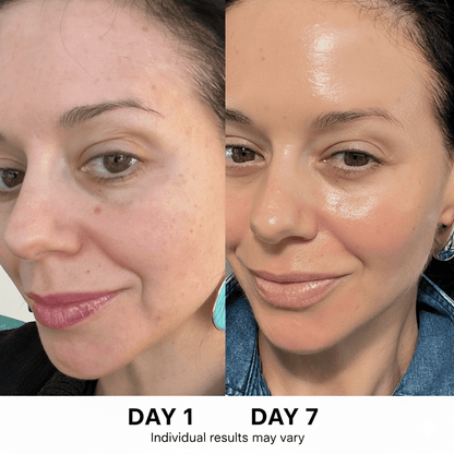 ANUA ultimate Korean skincare set - Heavenskin