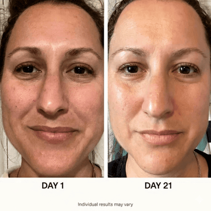 ANUA ultimate Korean skincare set - Heavenskin